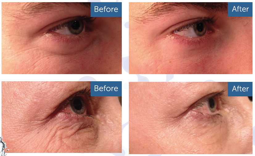 True science anti aging cream with Jackie Pack (part 1)